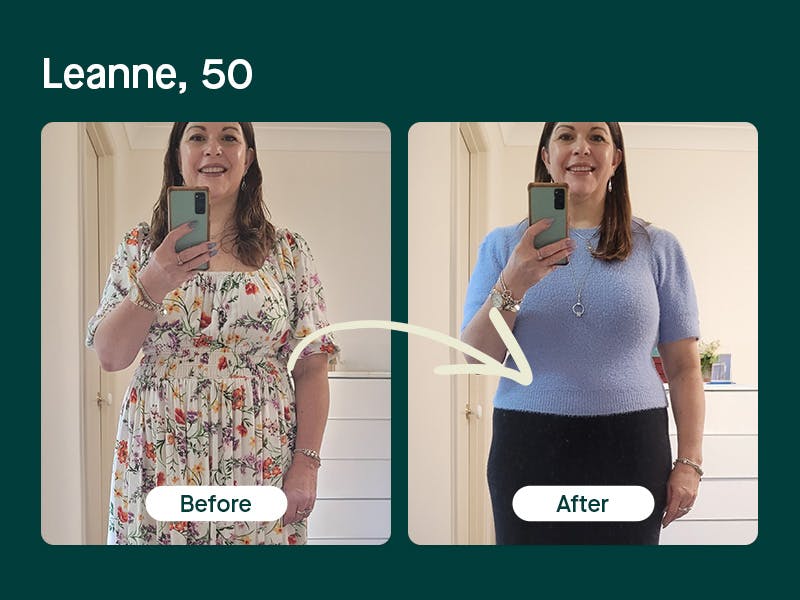 Mosh's weight loss treatment before and after - Leanne