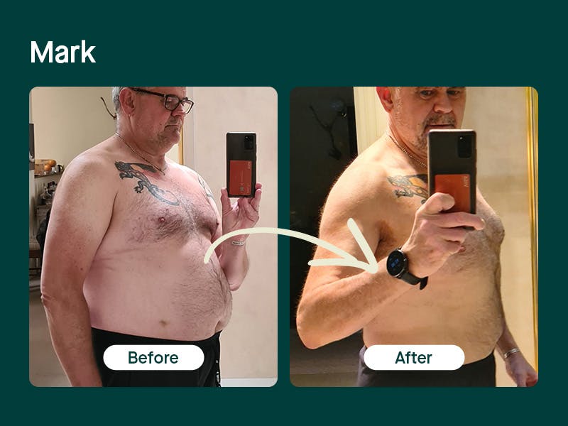 Mosh's weight loss treatment before and after - Mark