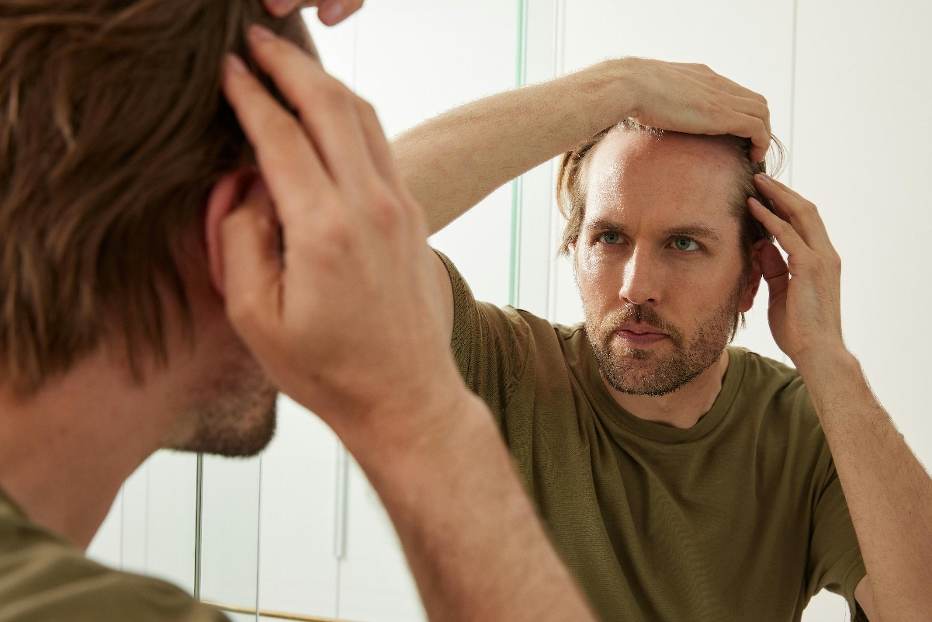 Man checking his hairline