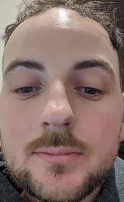 Tom After