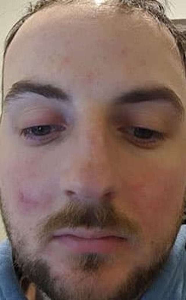 Tom Before