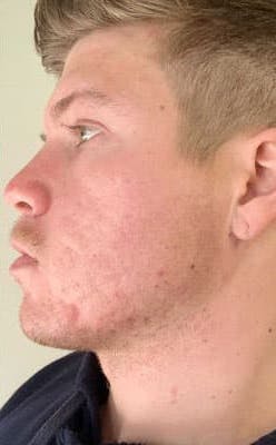Nathan After