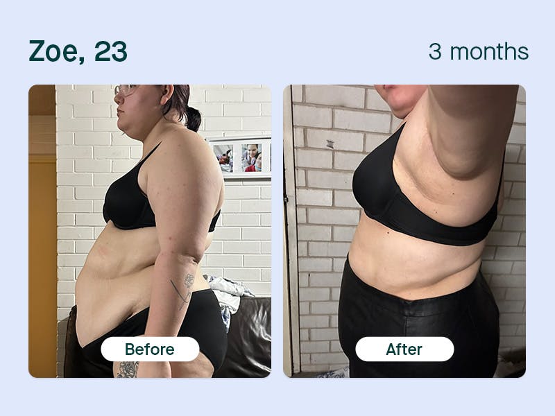 Zoe, 23yo lost 16kg in 3 months with Moshy weight loss prescription
