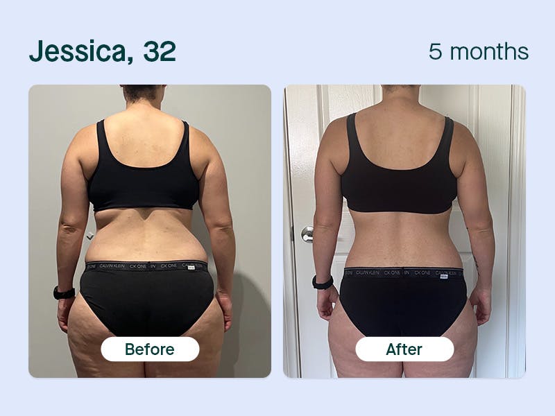 Jessica, 32yo lost 12kg in 5 months with Moshy weight loss prescription