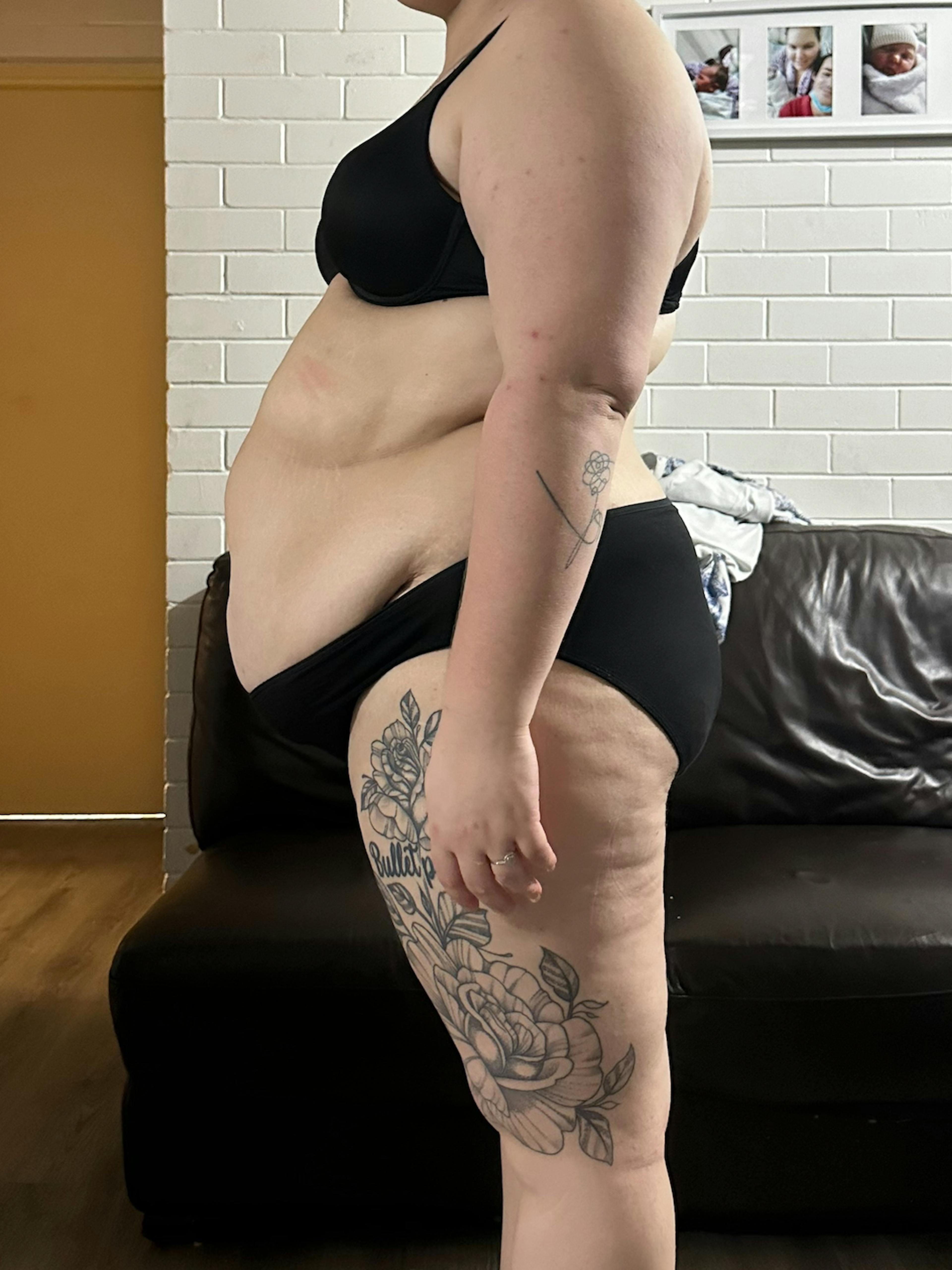 Zoe before photo