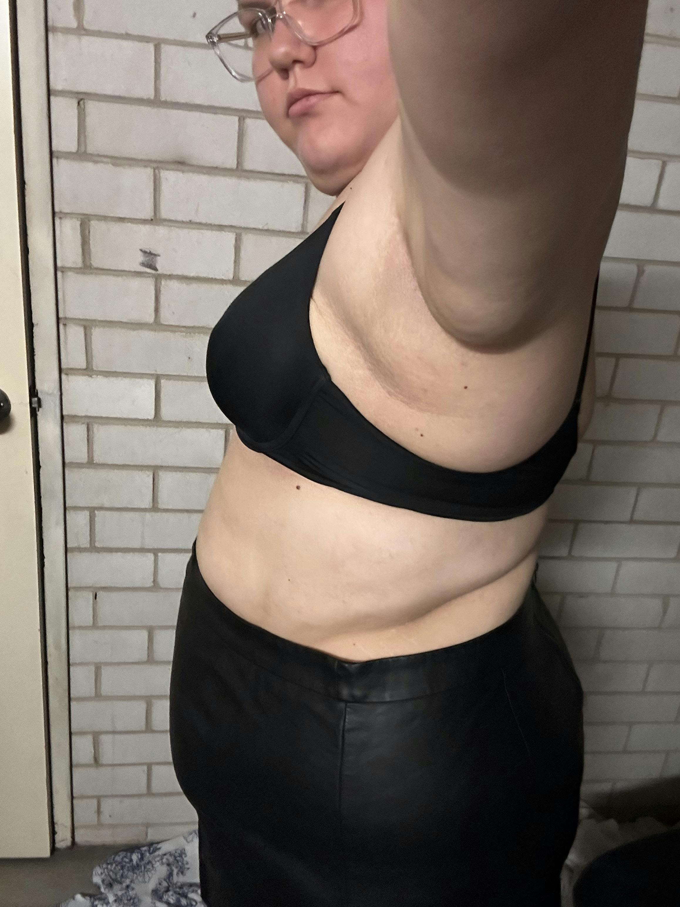 Zoe after photo 3 months
