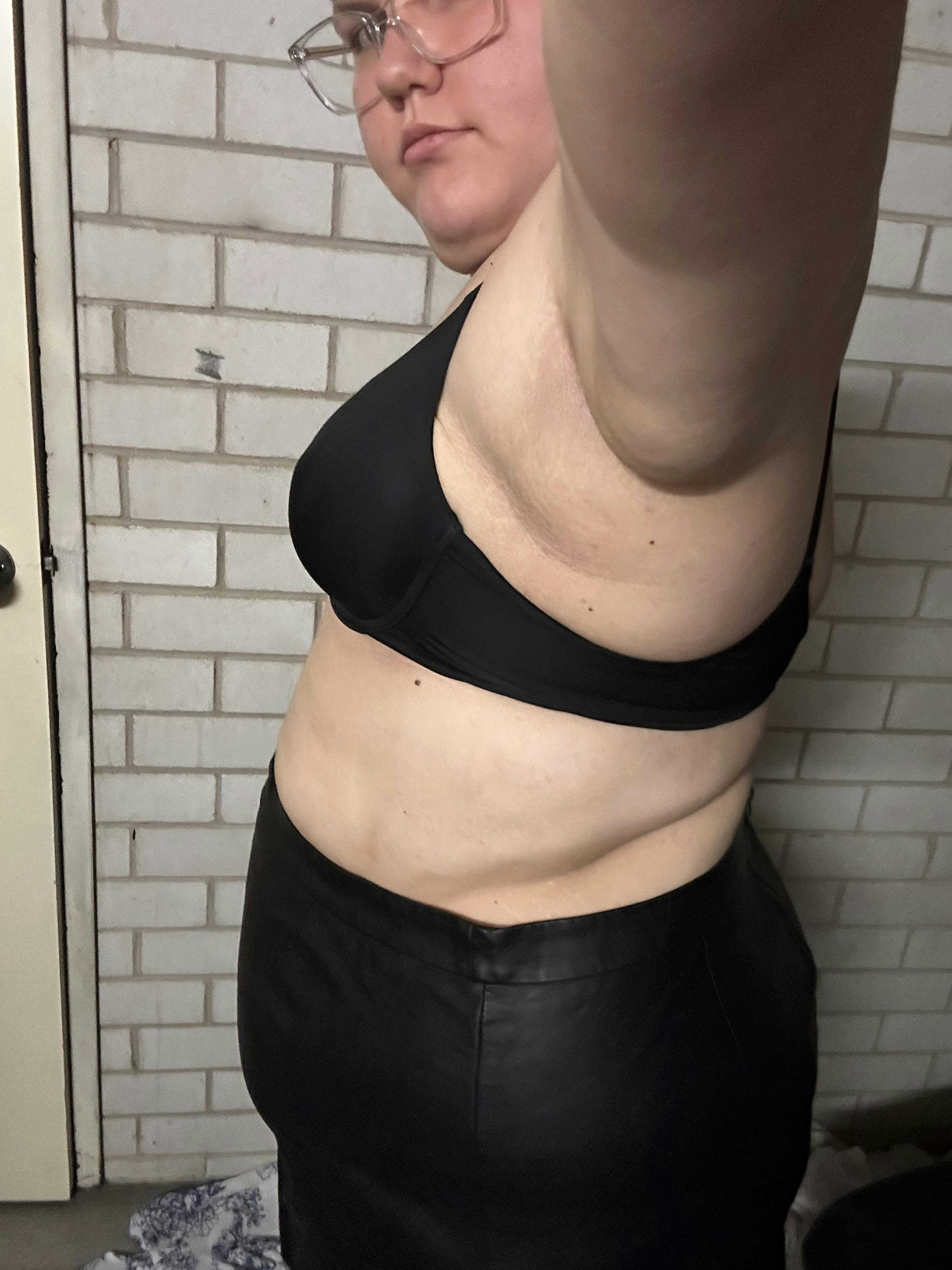 Zoe after photo 3 months