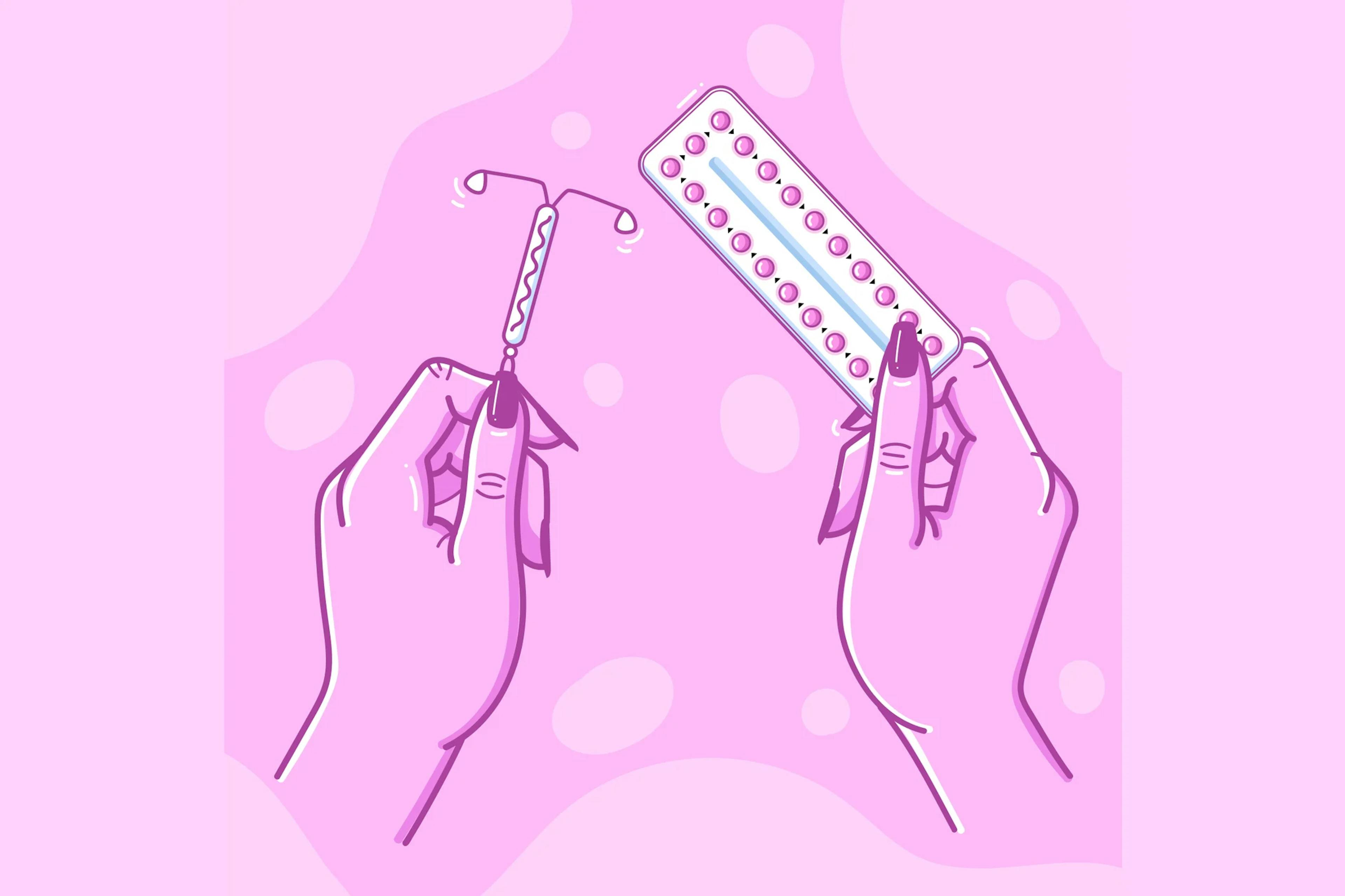Can IUDs (Like Mirena) Cause Weight Gain