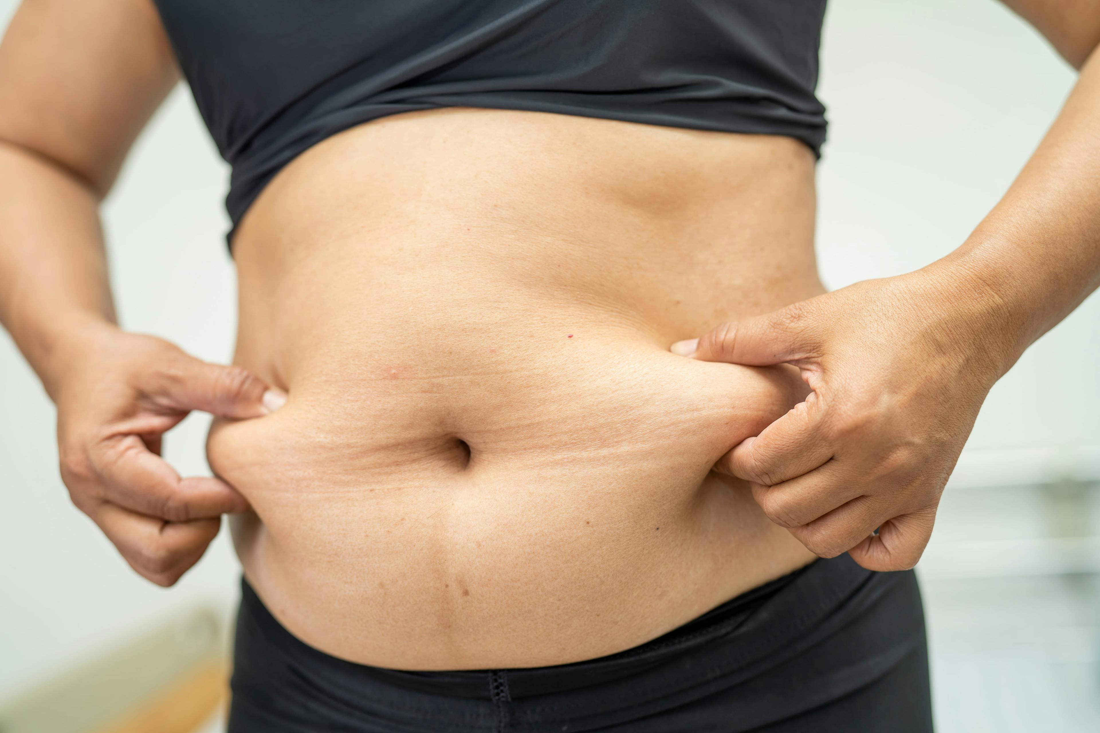 How to Get Rid of Love Handles