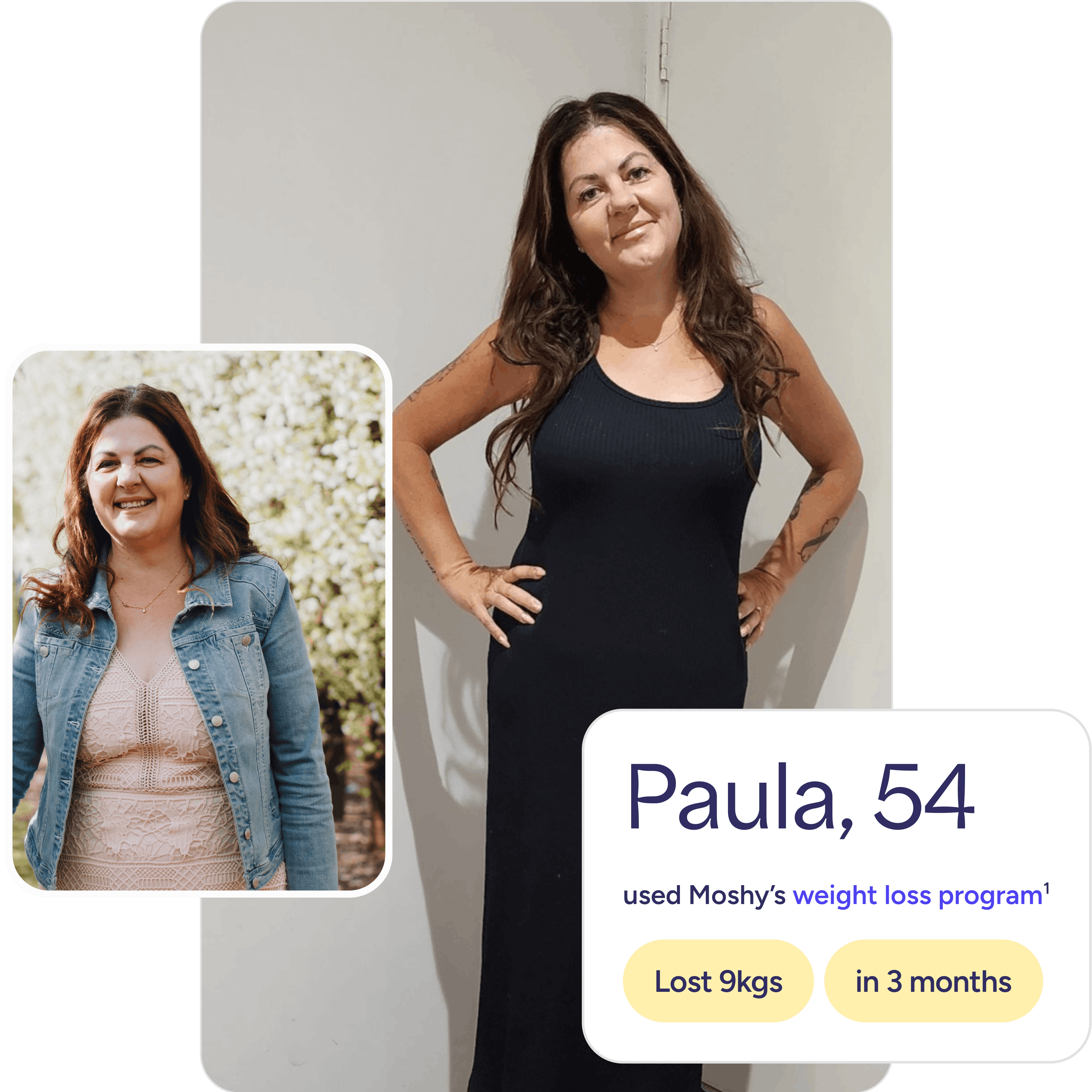 Paula before and after with Moshy's weight loss treatment