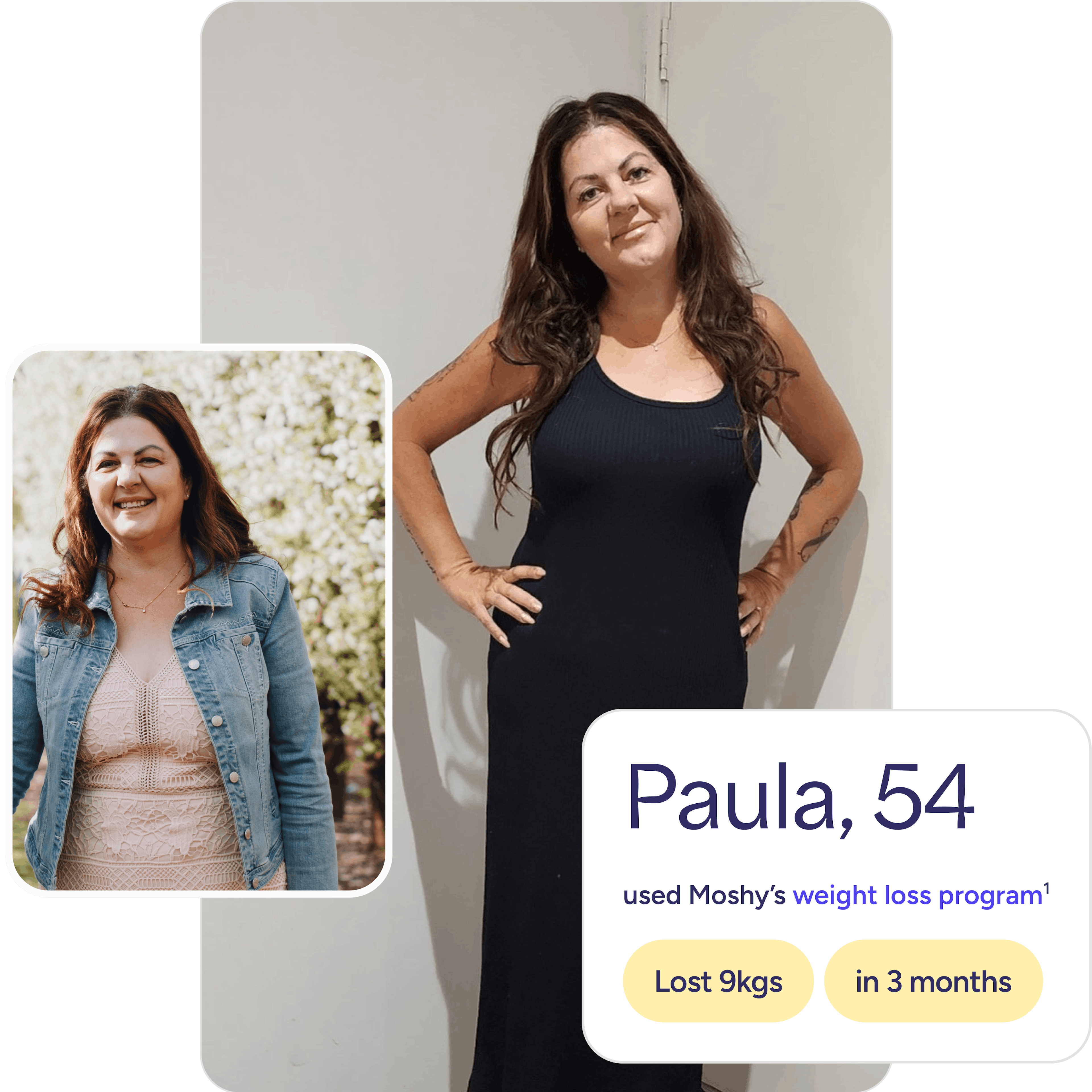 Paula before and after with Moshy's weight loss treatment 