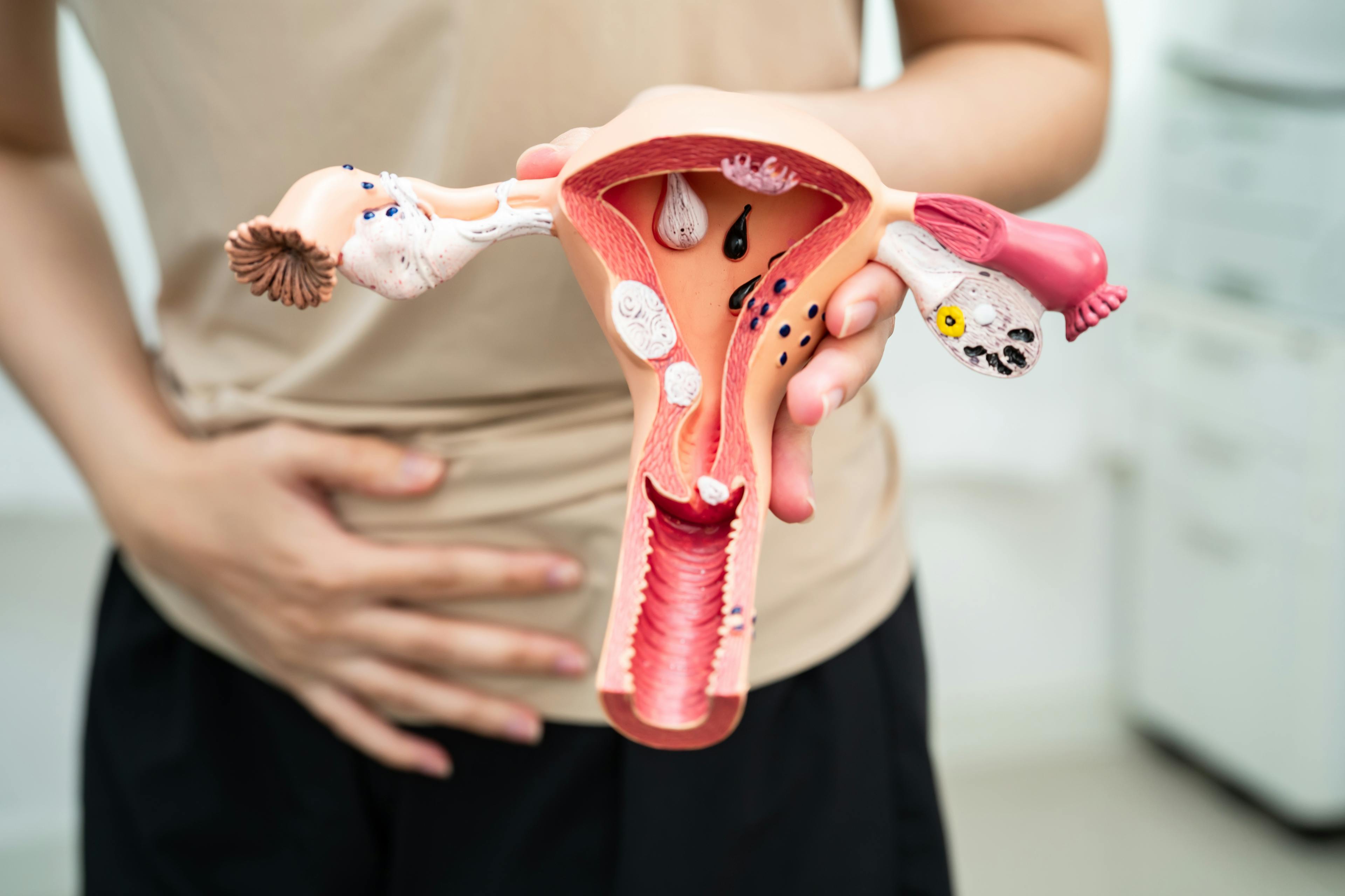 Woman holding a model of a uterus