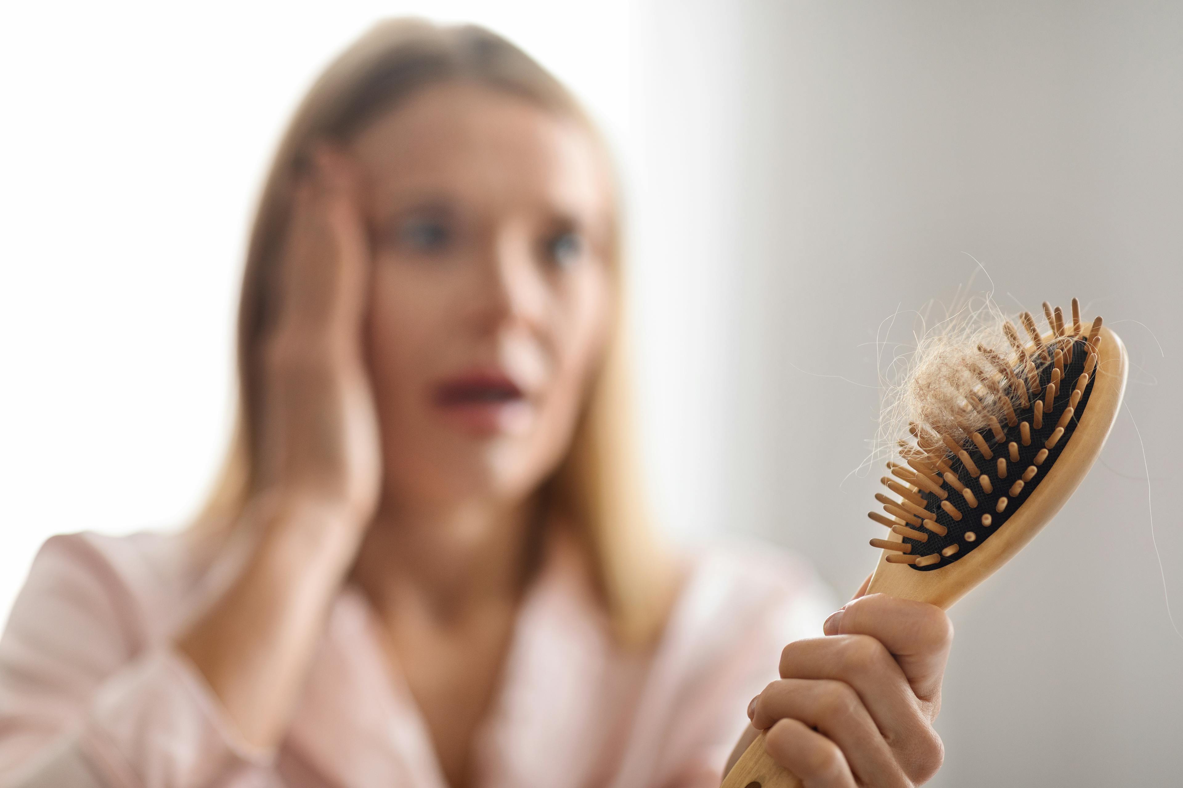 Hairloss Problem. Shocked Mature Woman Looking At Comb Full Of Fallen Hair