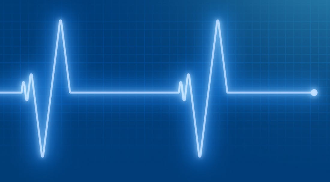 Image of chart with blue background.