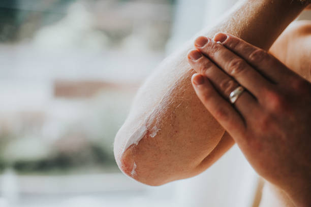 peau sèche