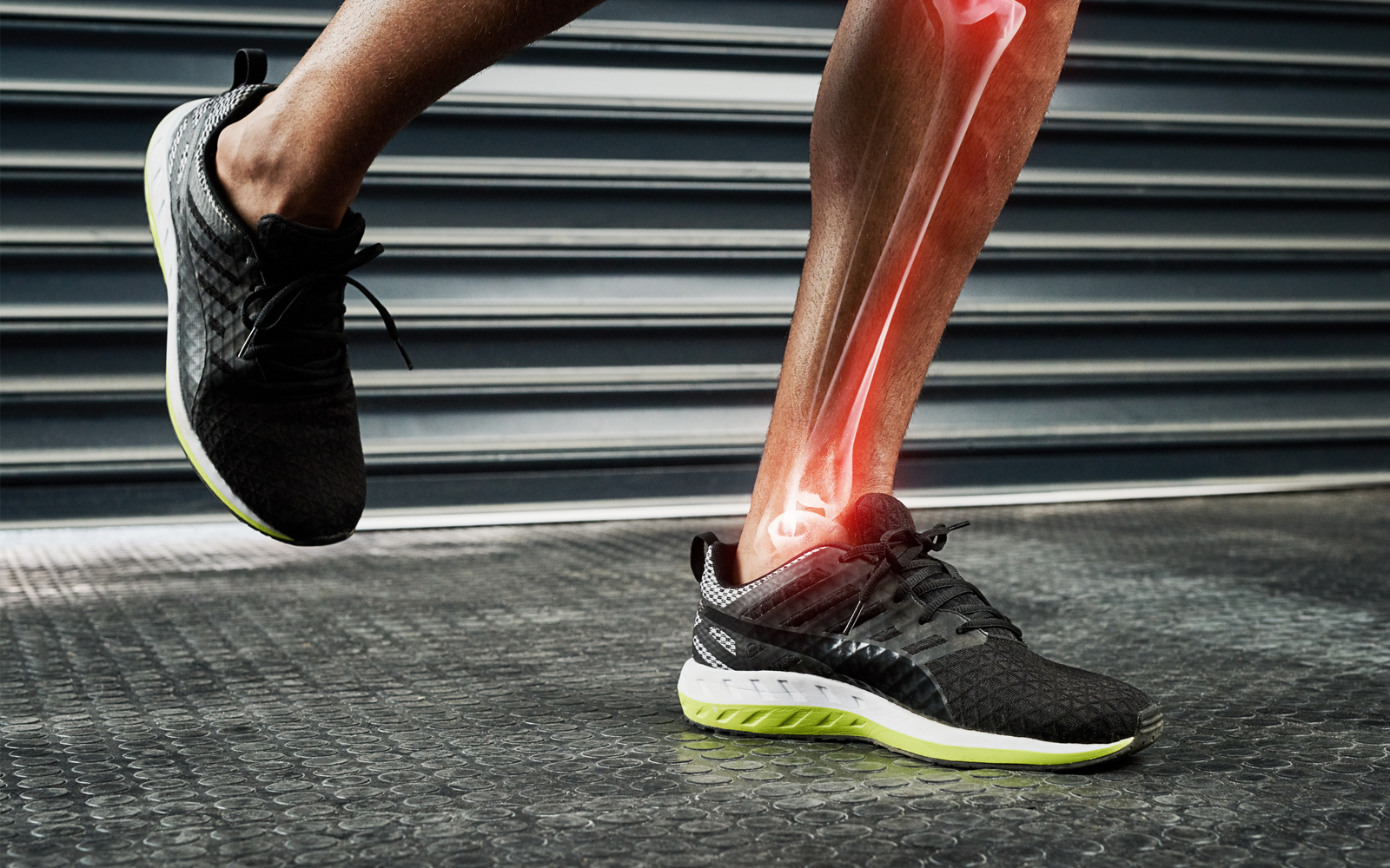 périostite tibia sport