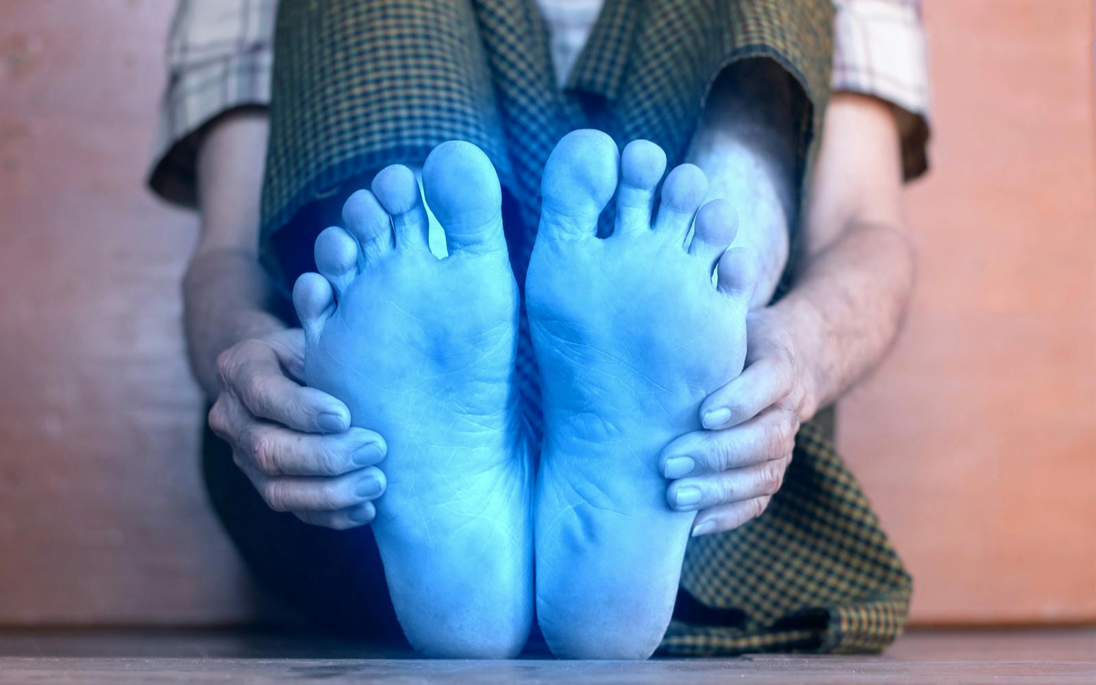 engelures pied hiver froid