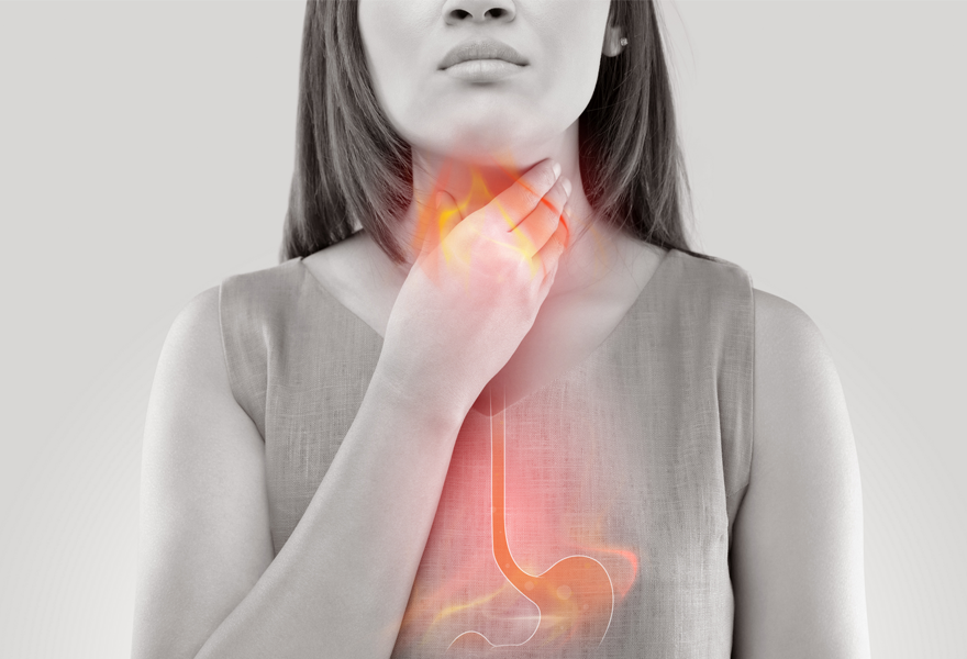 RGO reflux interne adultes et hoquet