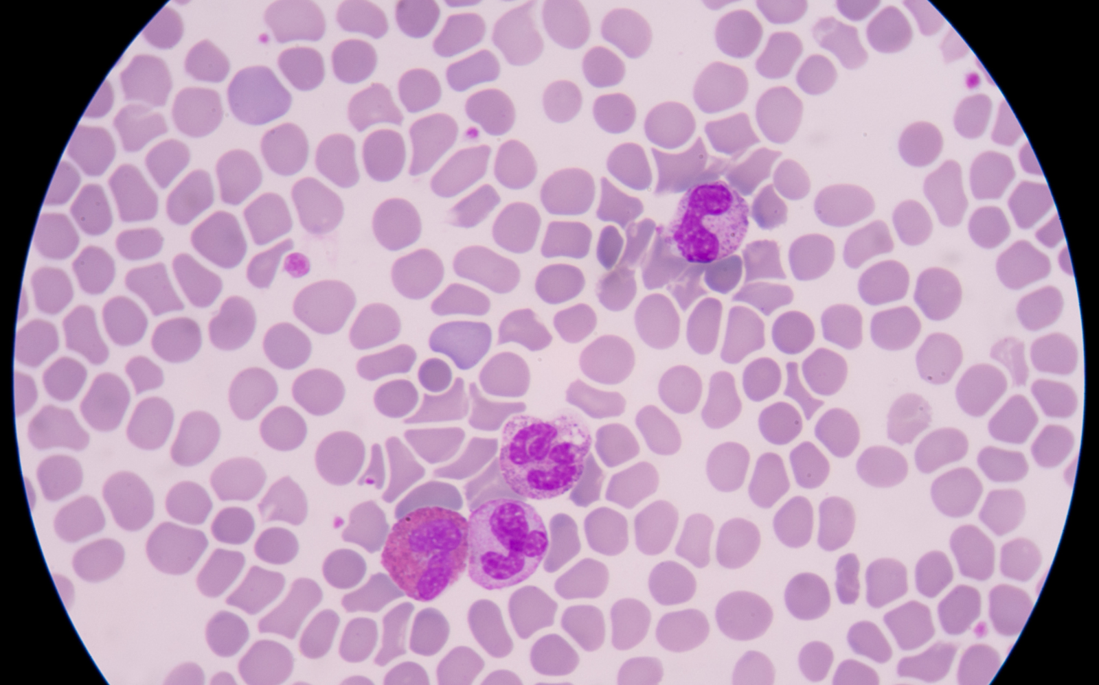 septicémie bactérie