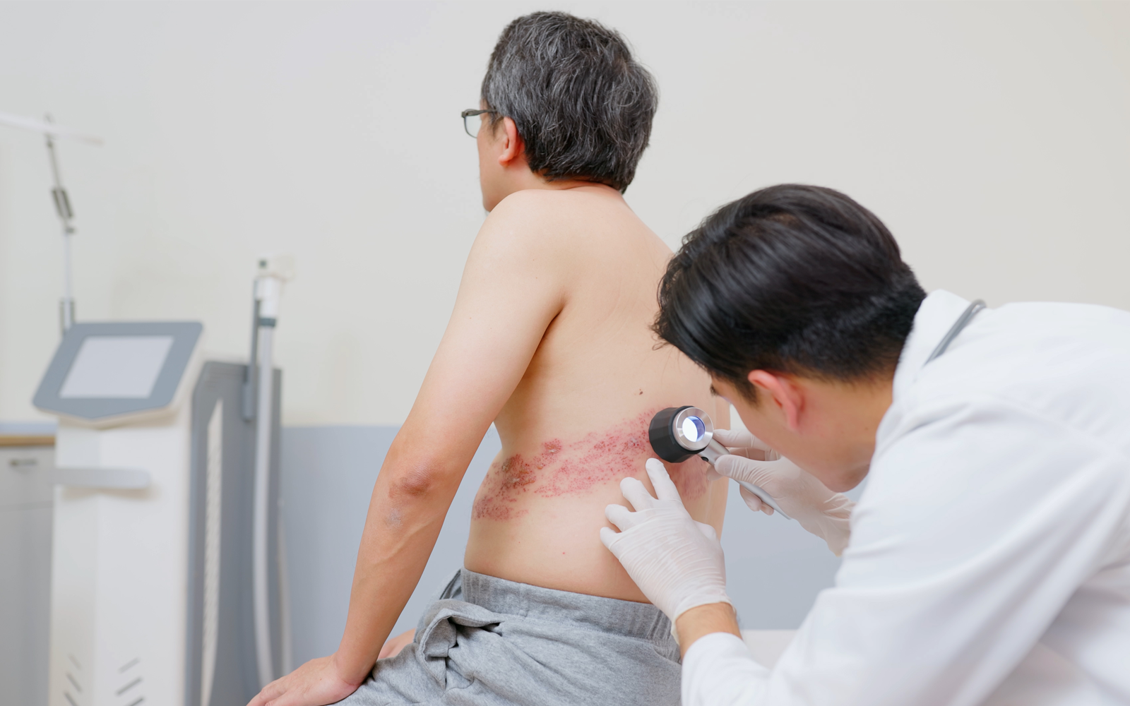 zona causes symptômes traitement giphar