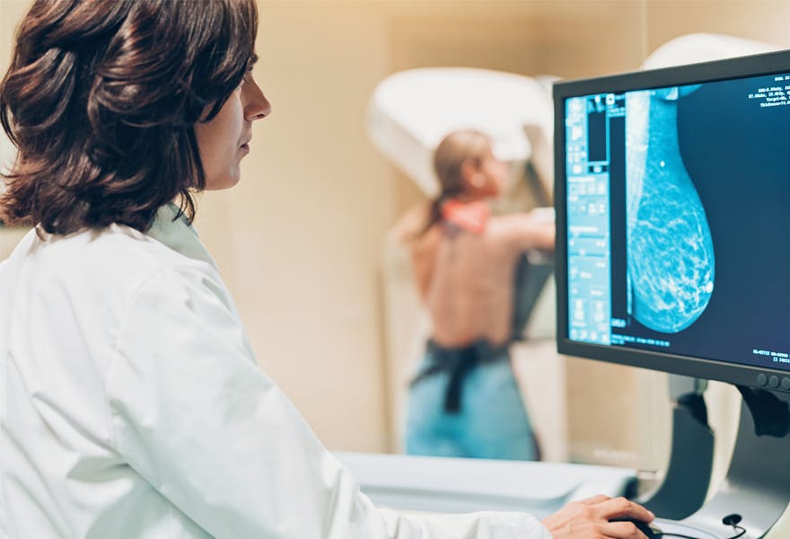 cancer du sein facteurs de risque giphar