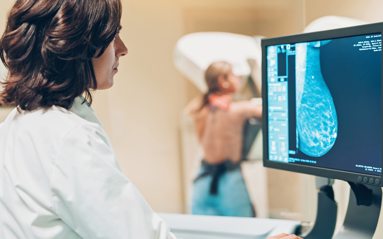 cancer du sein facteurs de risque giphar