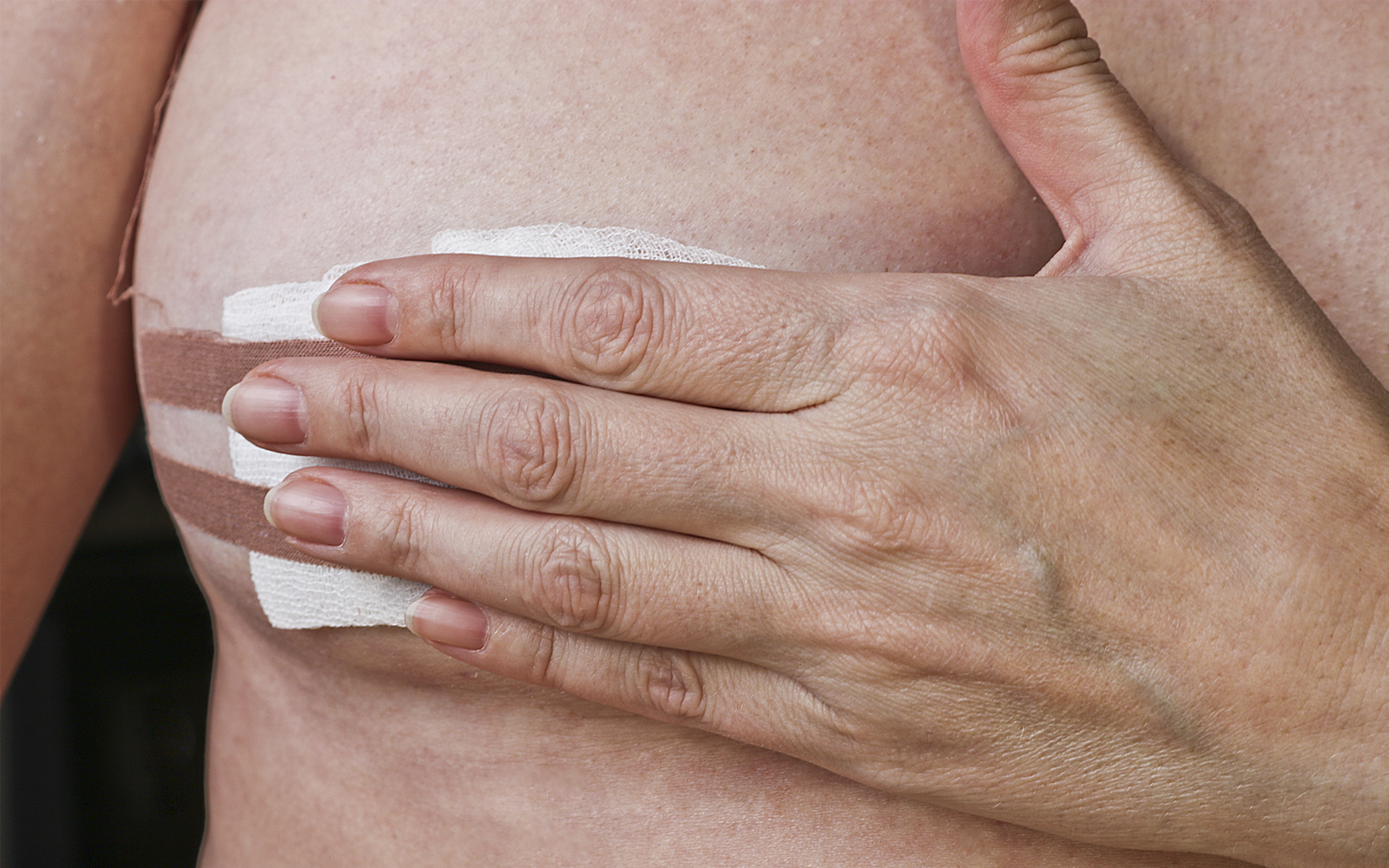 biopsie mammaire cancer du sein