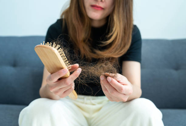 perte de cheveux