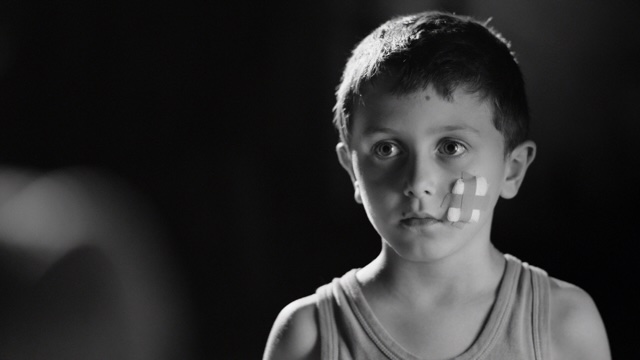 young boy with a bandage on his face
