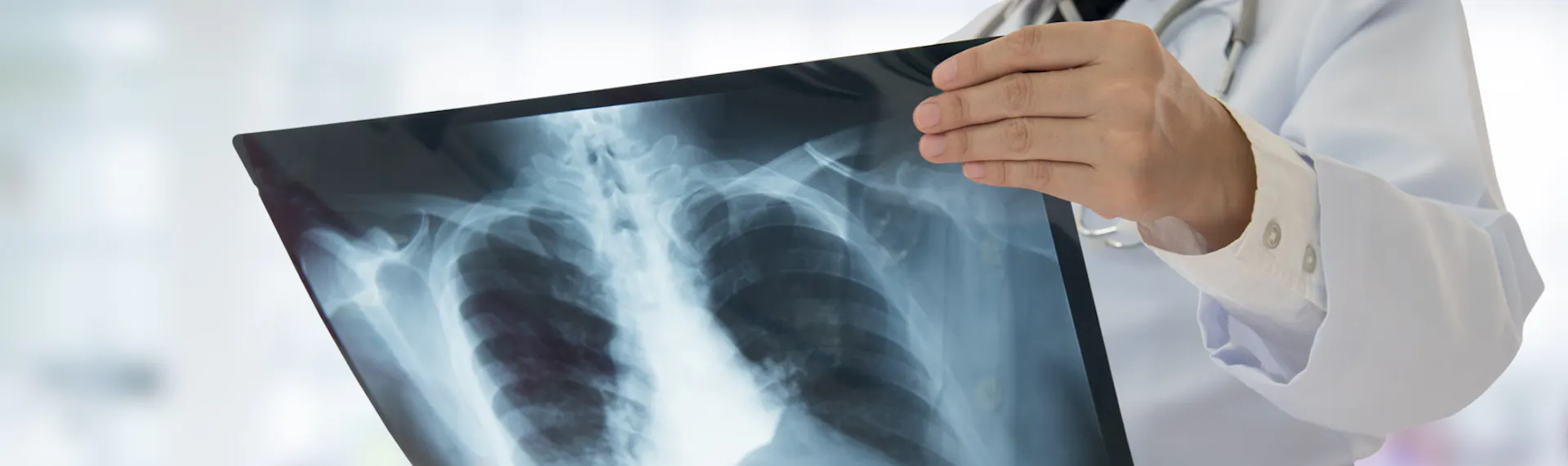 doctor examining xray