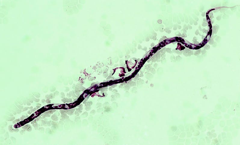 An image of a microscopic view of a heartworm