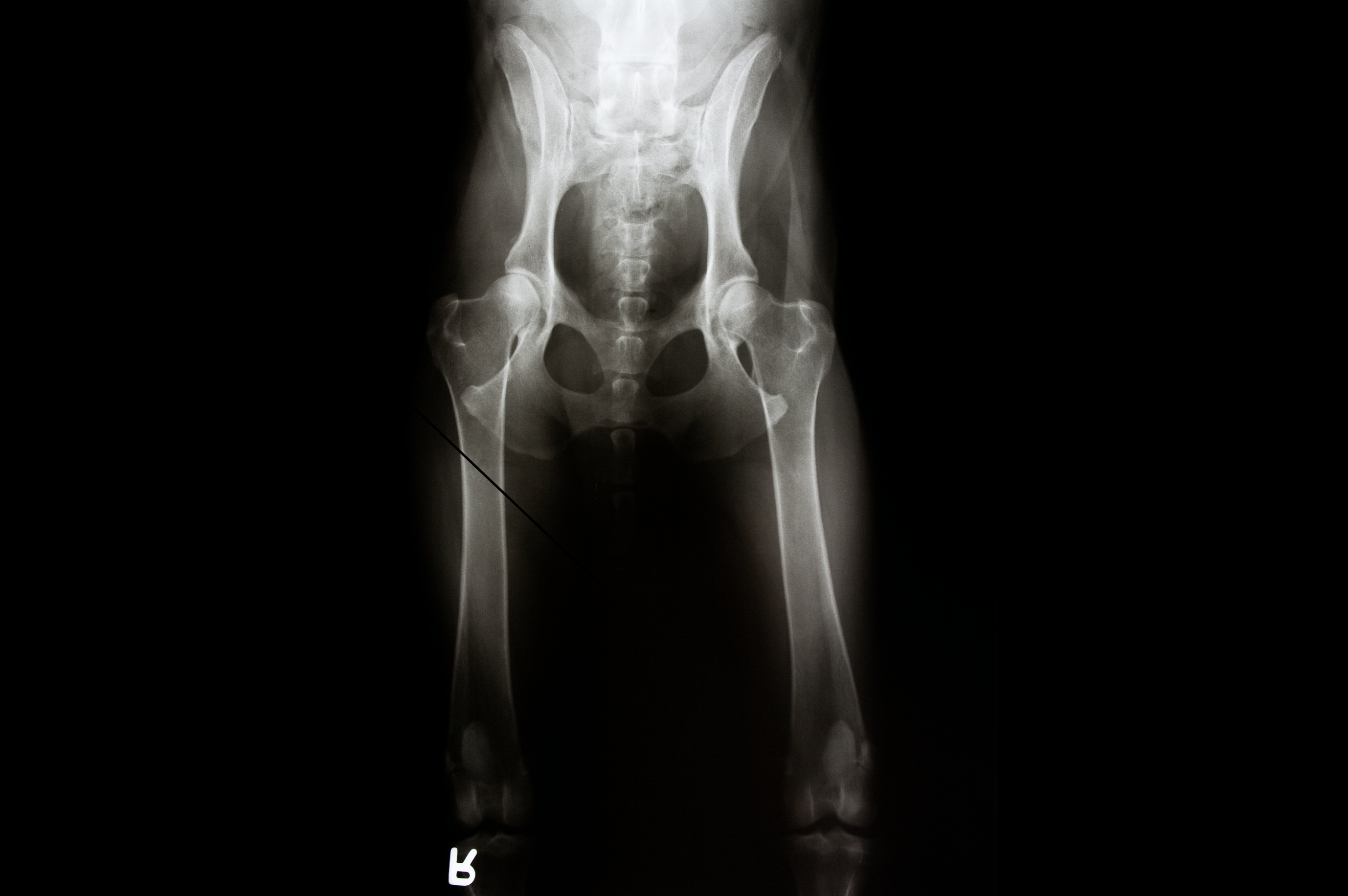 An x-ray of a dog's hips