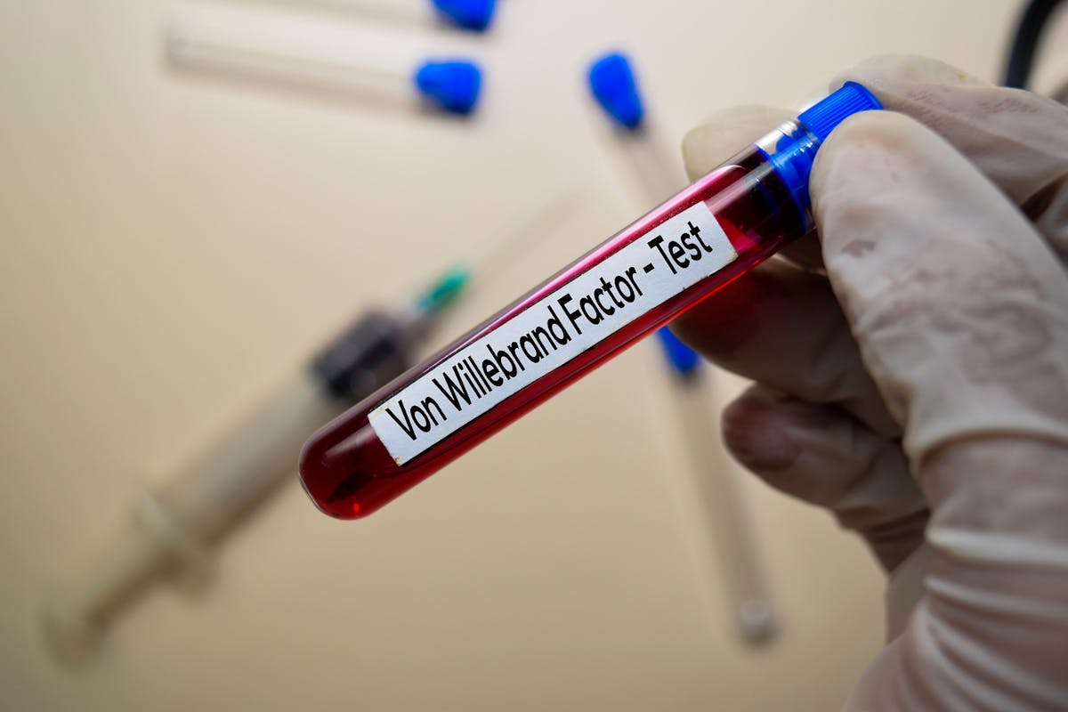 a test for von willebrand factor