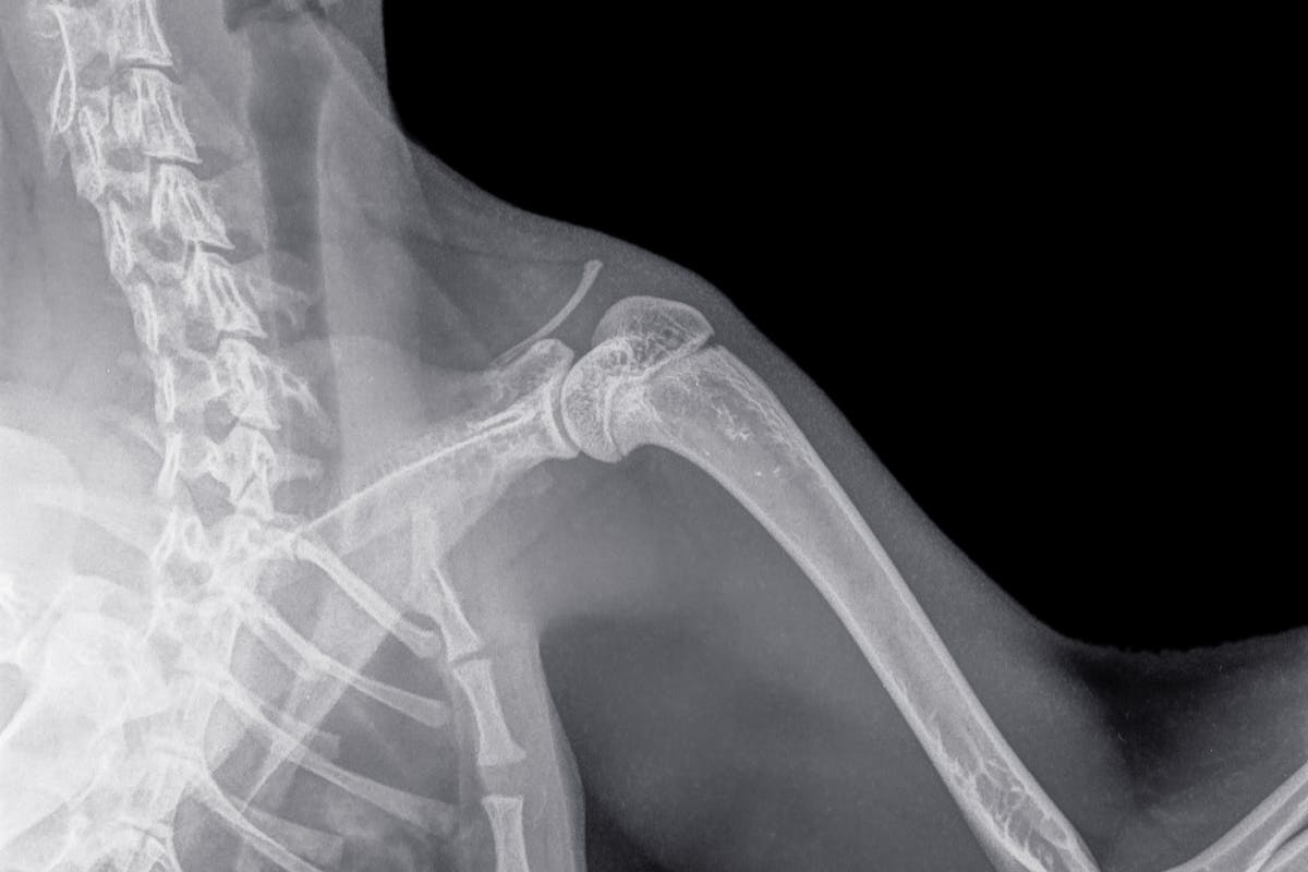 An x-ray of a dog's shoulder
