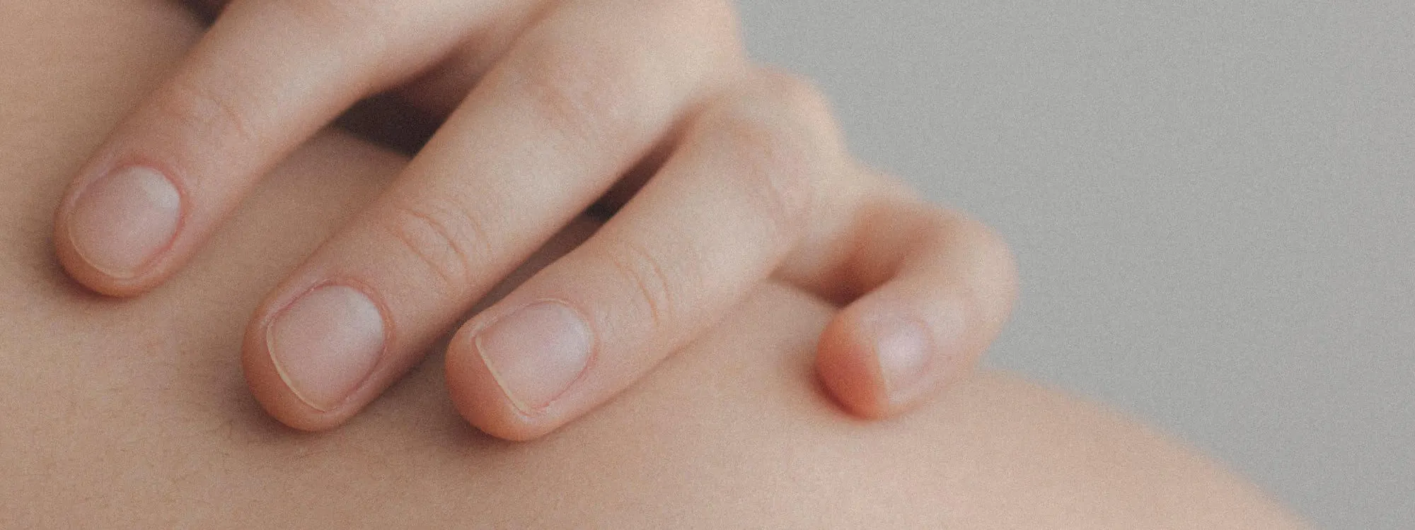 Malignes Melanom – Hautkrebs