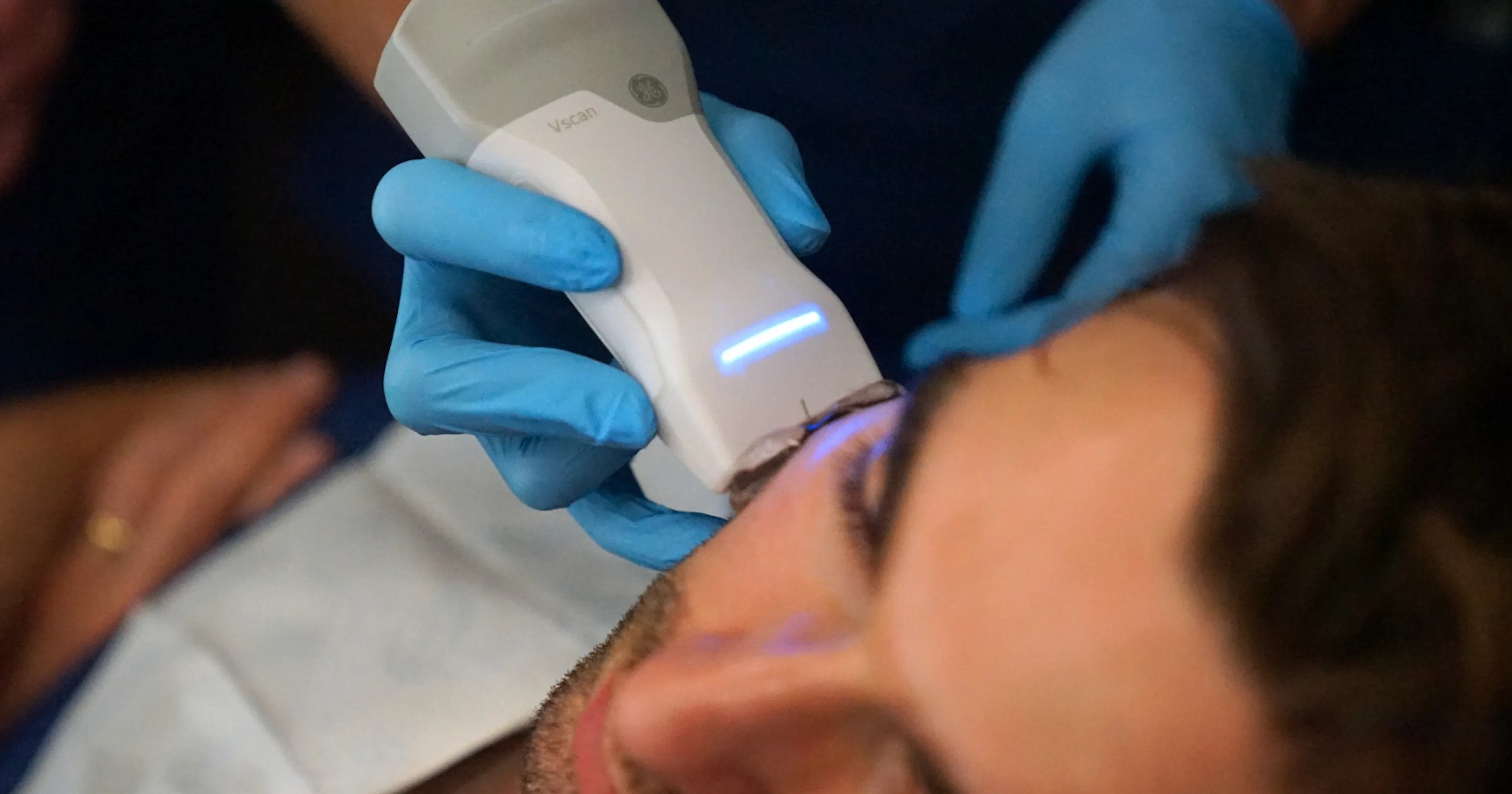 Managing aesthetic complications from filler - ultrasound at the Aesthetics Referral Centre
