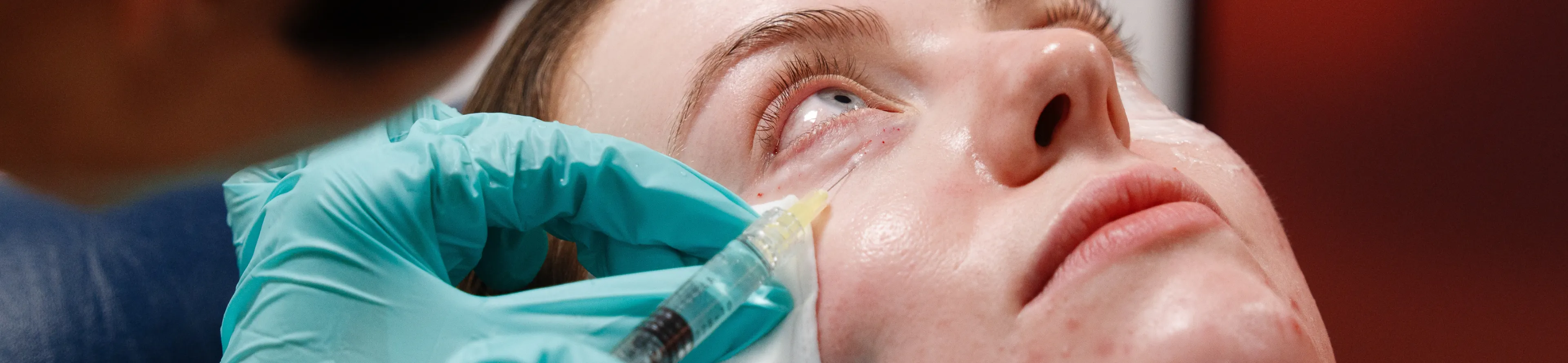 Under eye injections polynucleotides training course at Harley Academy