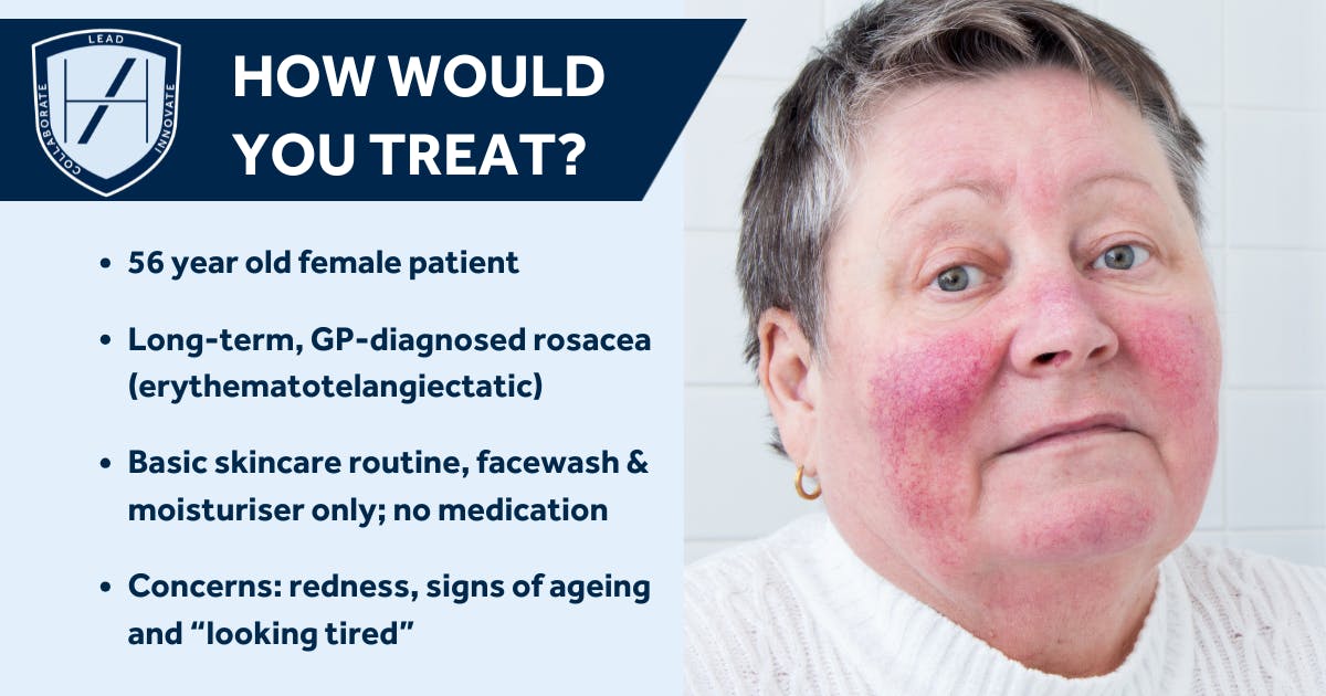 Case Study - How Would You Treat this Rosacea Patient's Aesthetic Concerns?