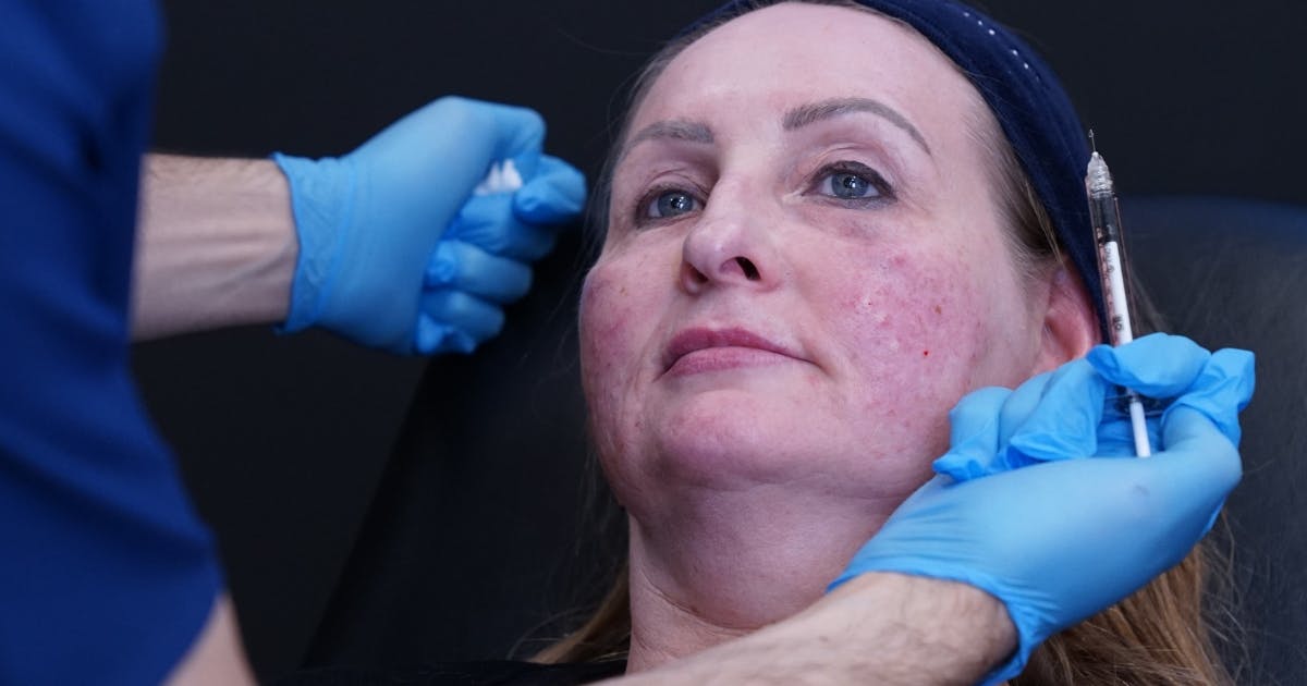 polynucleotides training course full-face treatment session