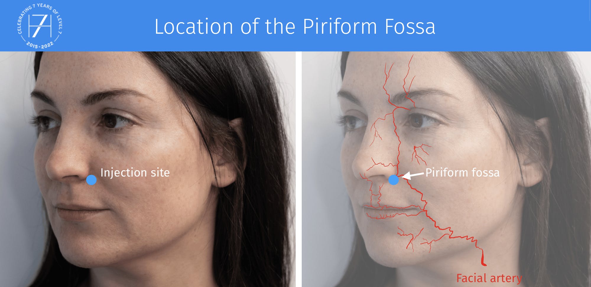 Where is the piriform fossa located