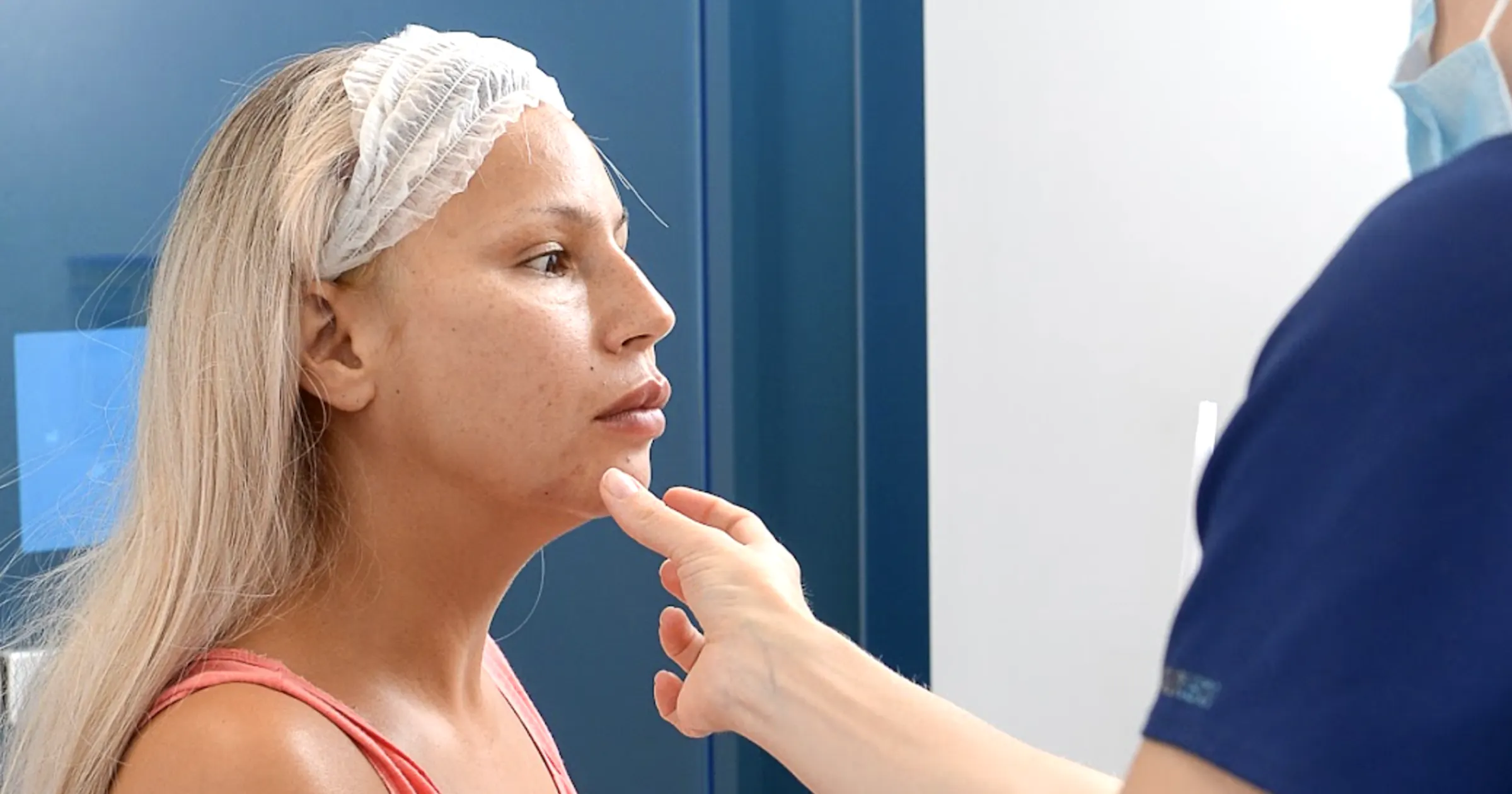 How to identify Lip Filler migration