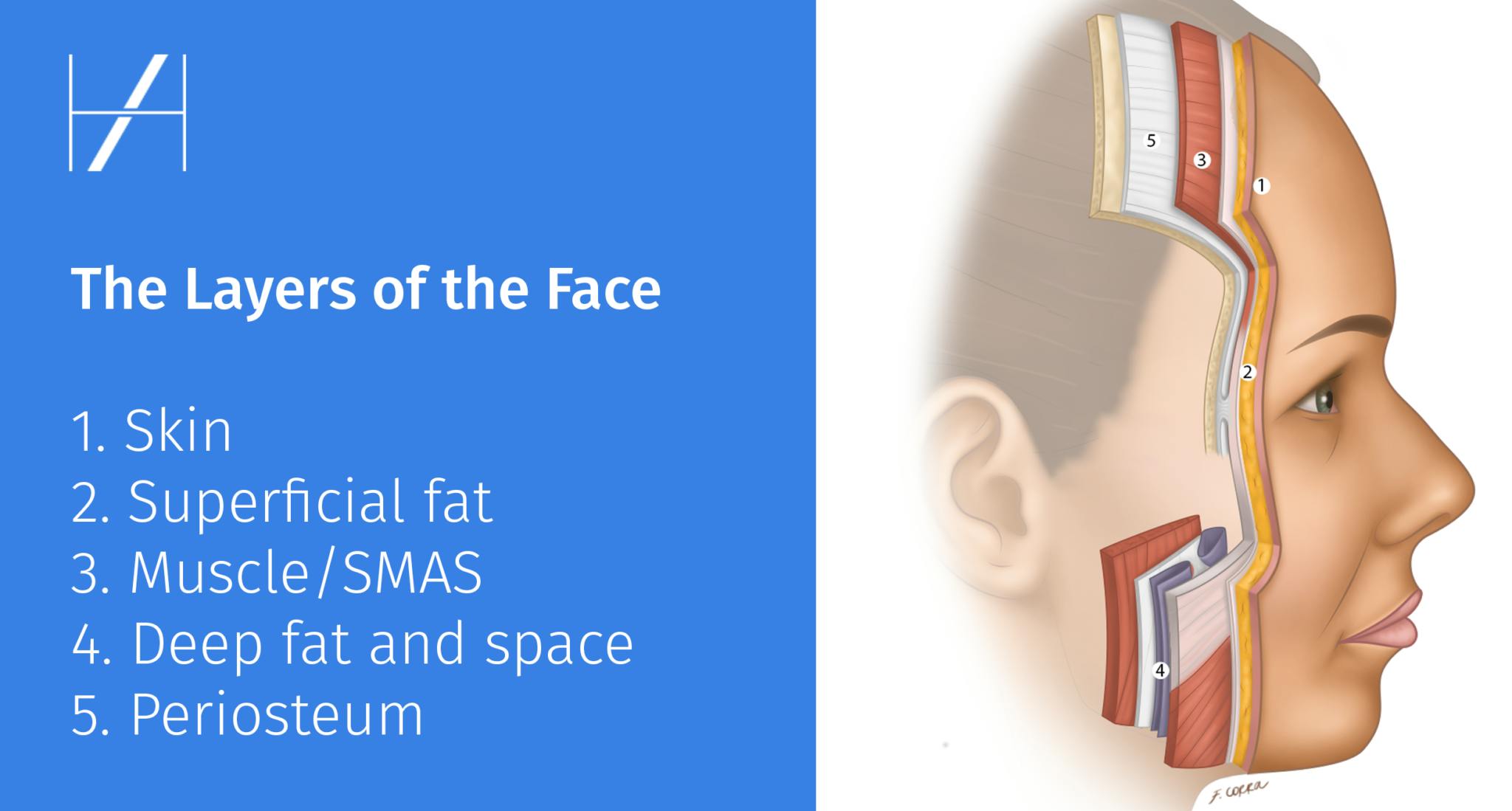 Layers of the face facial anatomy Learning to use a cannula for filler treatments