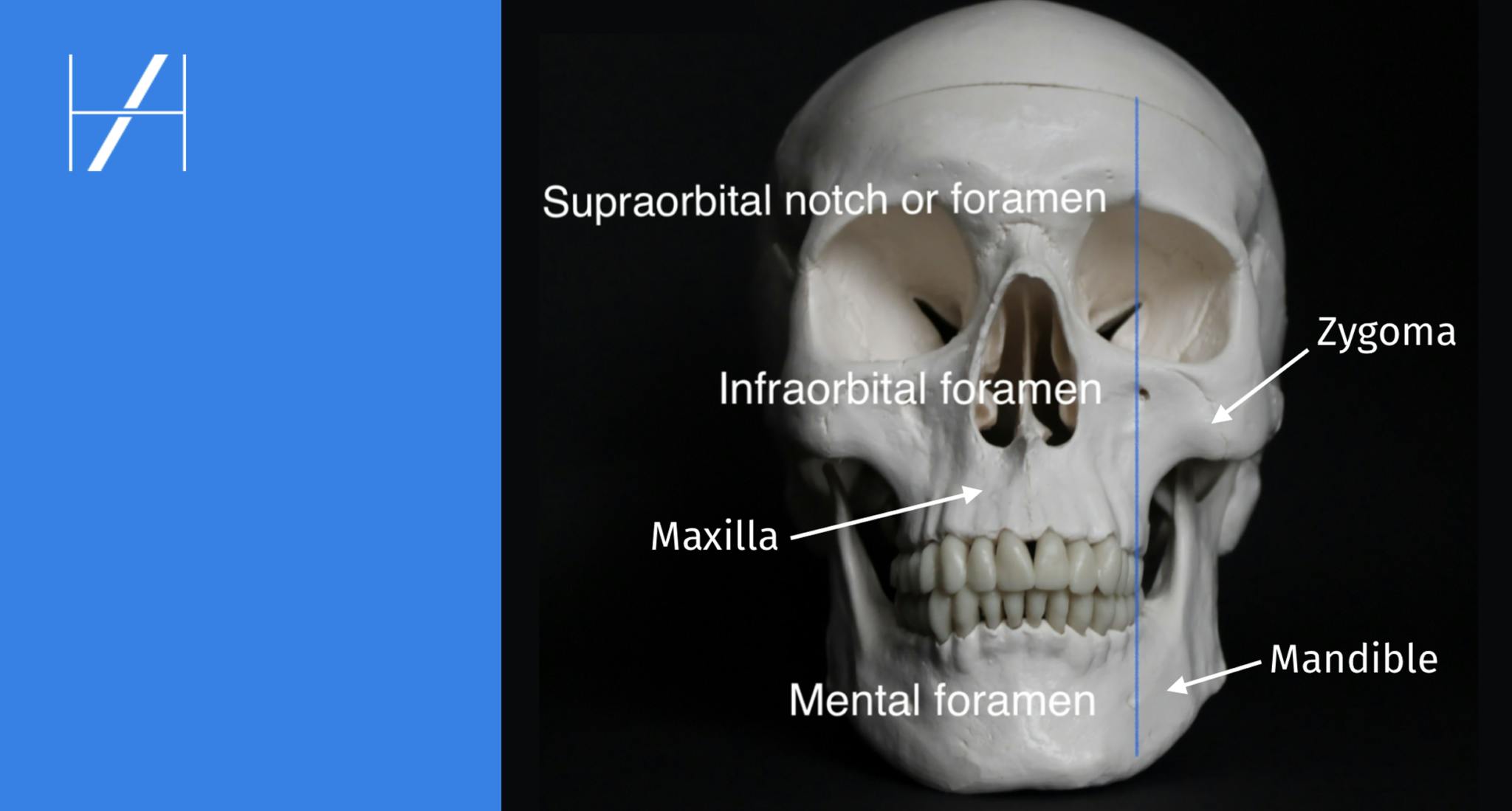 Skull diagram facial anatomy