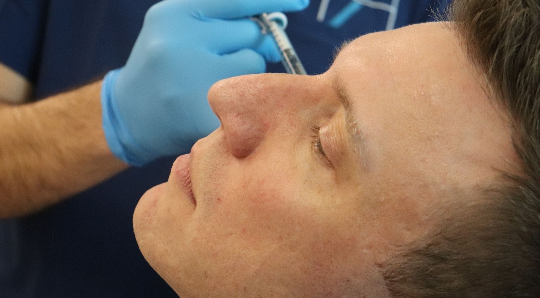 How to Avoid Common Cheek Filler Mistakes as a New Injector