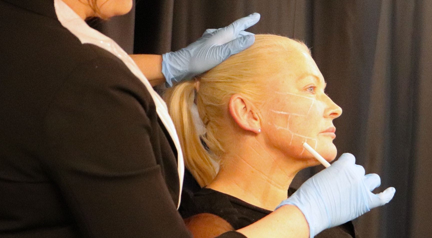 TOP BOX How to treat sagging jowls with filler - Harley Academy medical aethetics training courses London