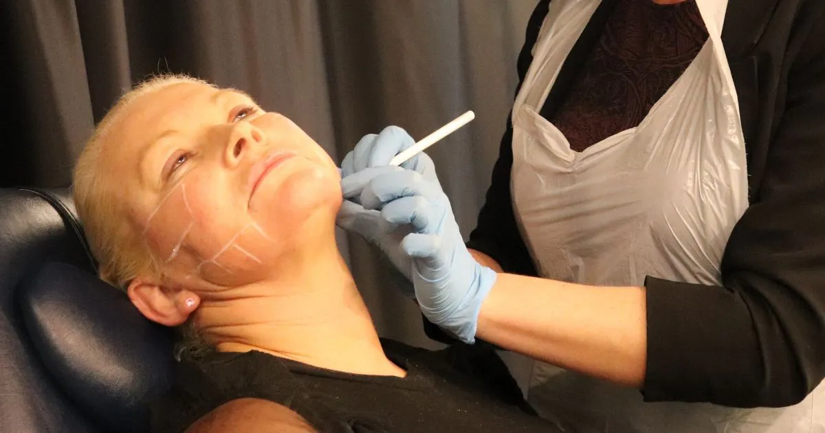 how to inject ghk-cu in jowls Treat Sagging With Filler Choose Location:Queens firm skin Mazdutide | Modern Peptides