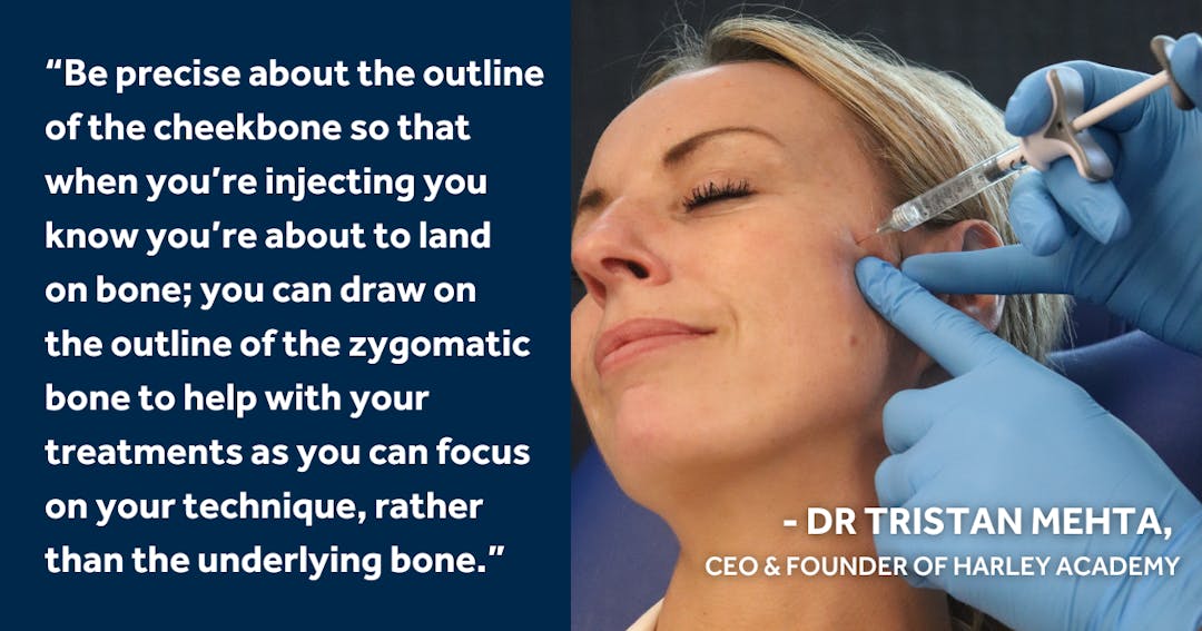How to Avoid Common Cheek Filler Mistakes as a New Injector