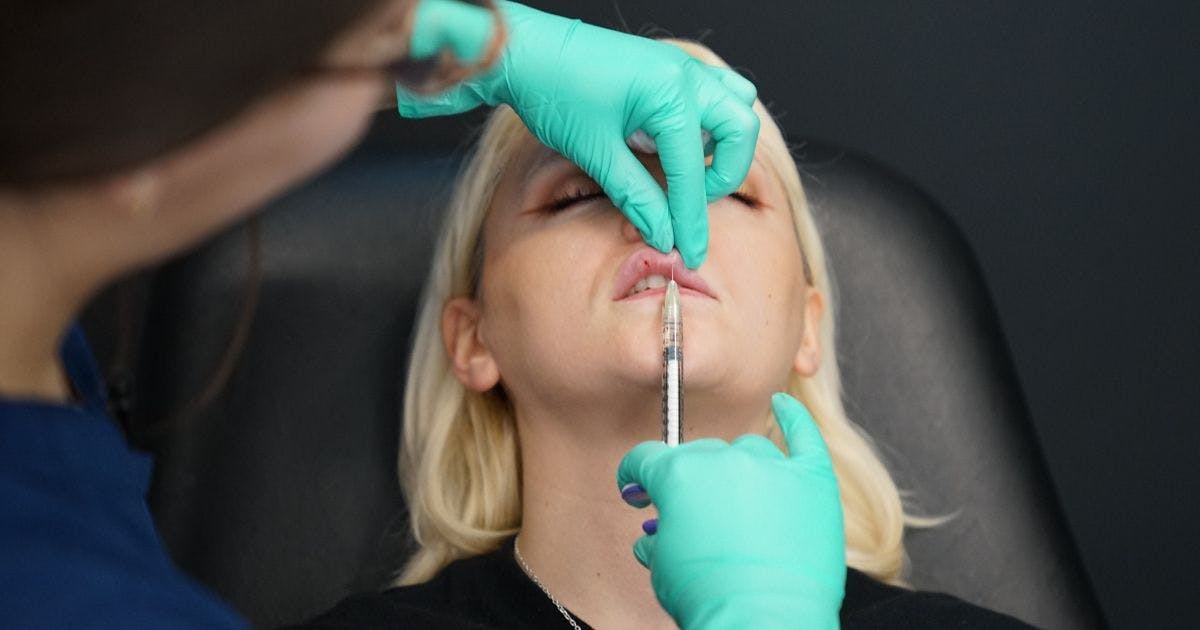 Lip Filler Course Injection Technique