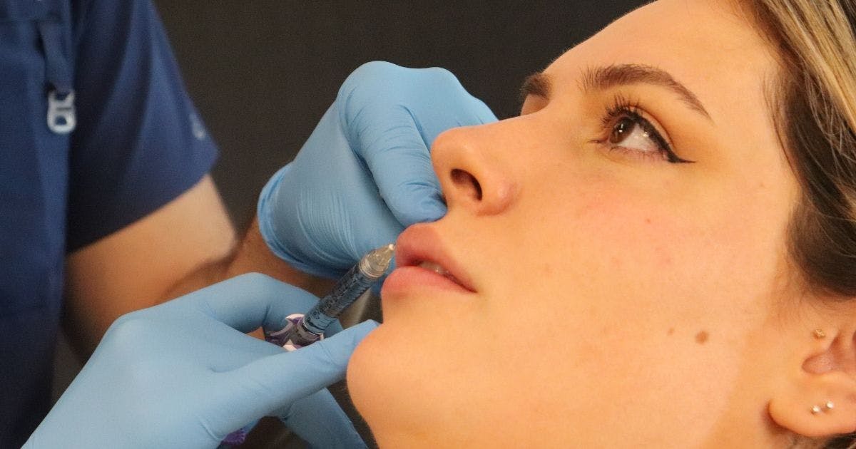 How to Inject Lip Filler Safely and Effectively