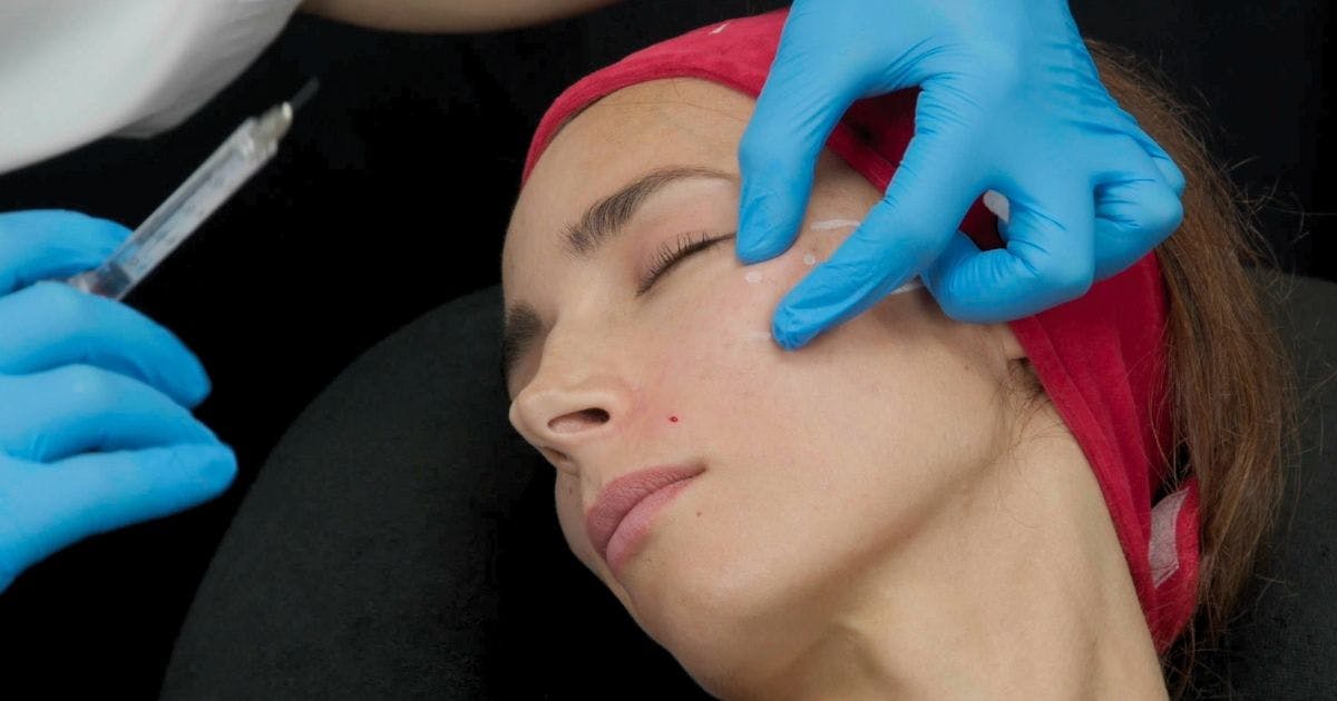 Subtle Facial Rejuvenation Cheek Filler Mid-Face Filler Demonstration